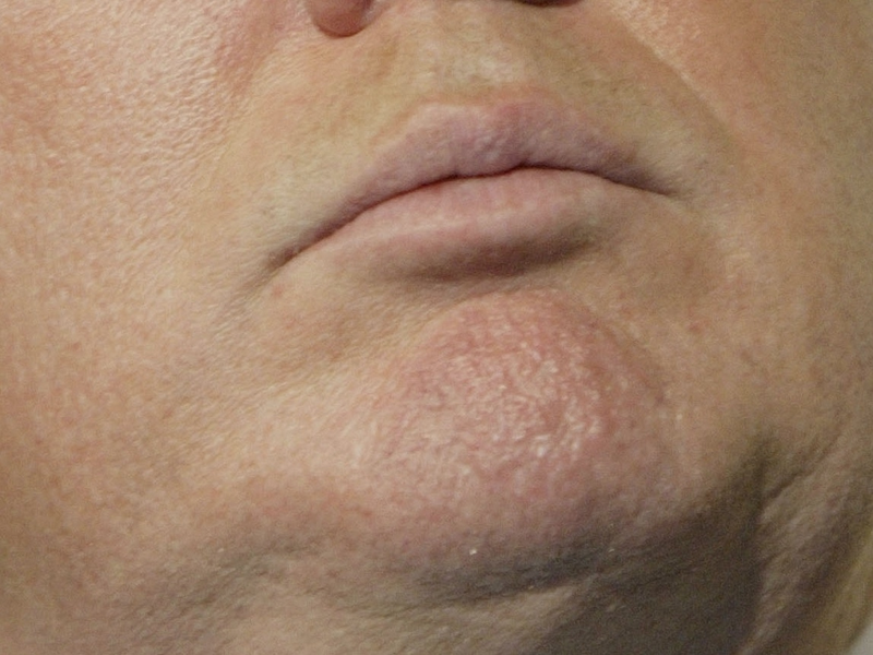 Illustration for article titled A Visual History of Donald Trump's Mouth